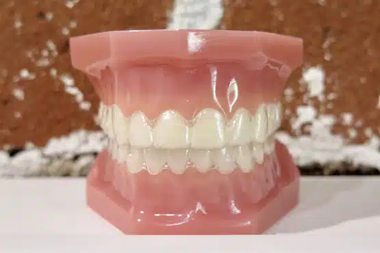 invisalign