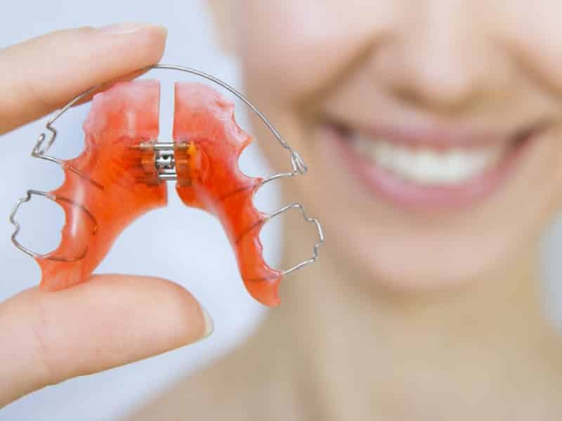 Traditional Expanders