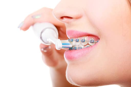 Braces care in Westwood Orthodontics