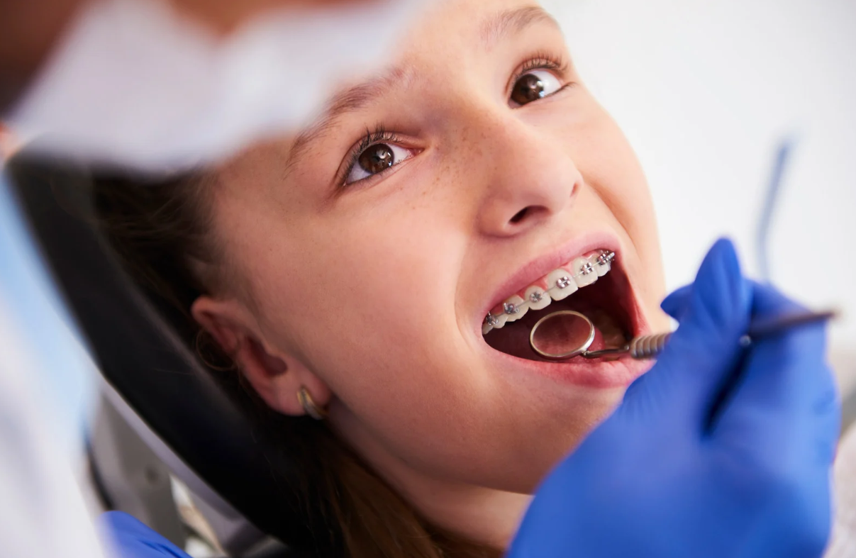 Choose an Orthodontist Over a General Dentist