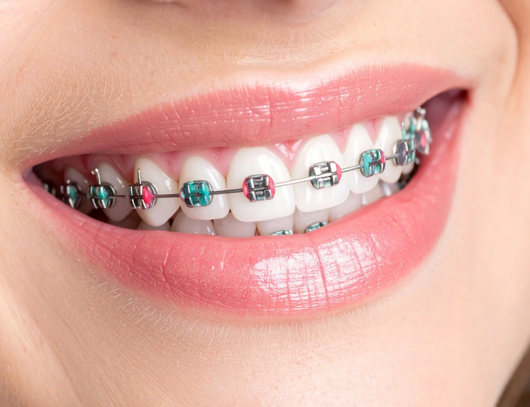 What Determines the Cost of Phase 1 Treatment?