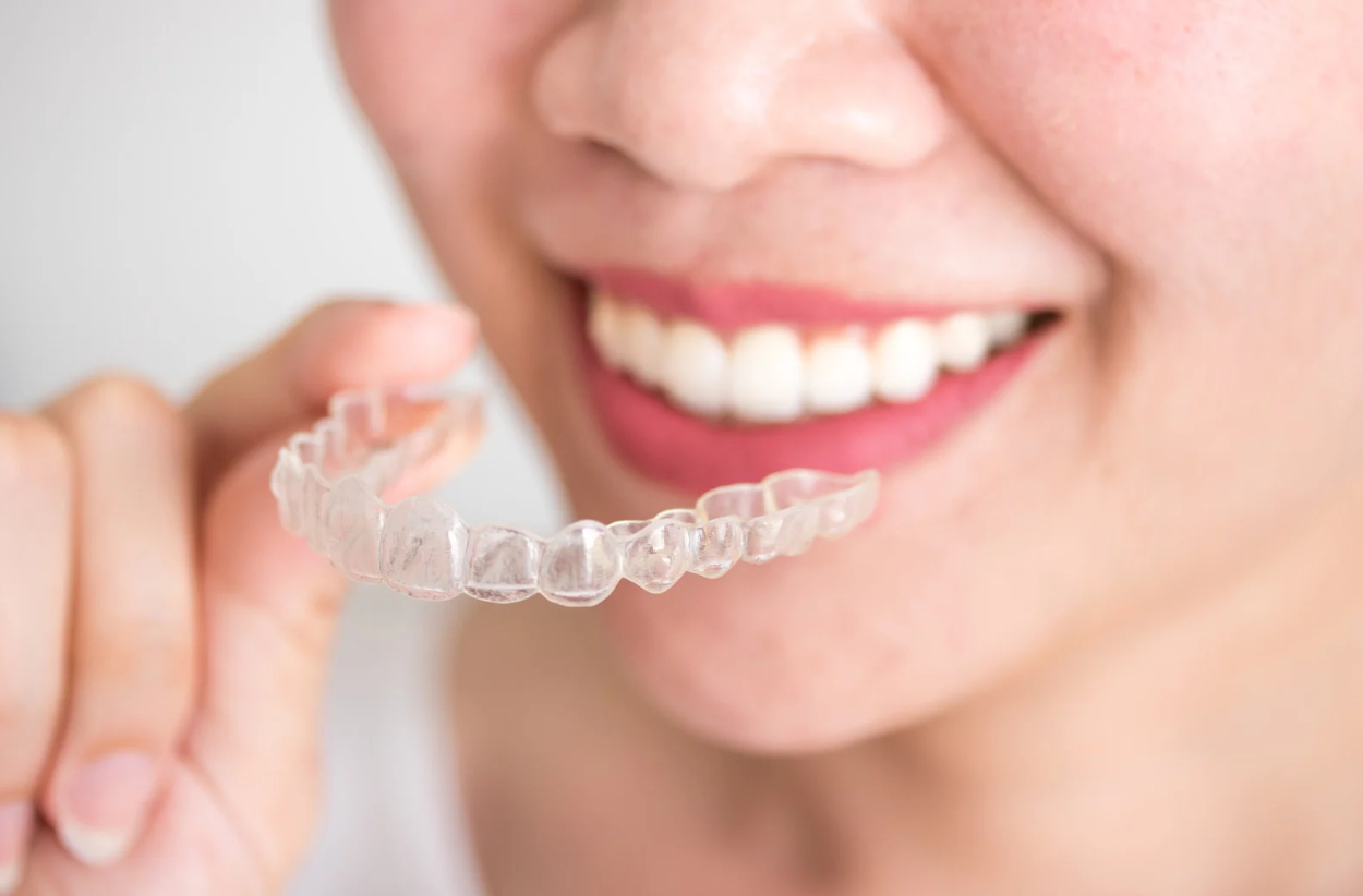 What Is Invisalign First?
